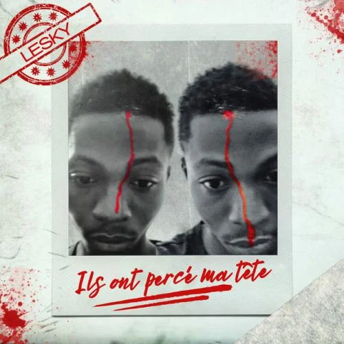 LESKY - Ils Ont Percé Ma Tête